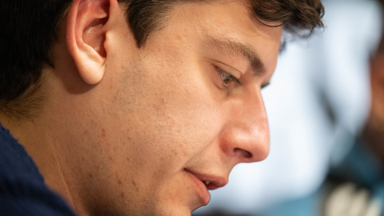 Miguel truca unos ases y destroza a Alberca